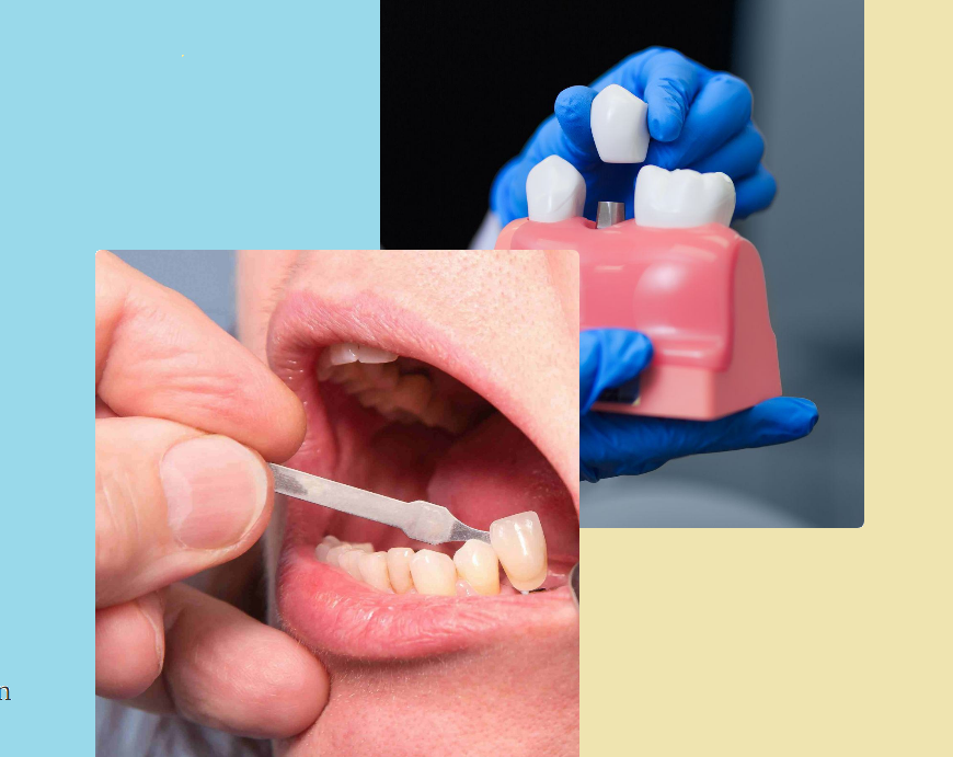 Wisdom Teeth Solutions